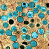 virus particles